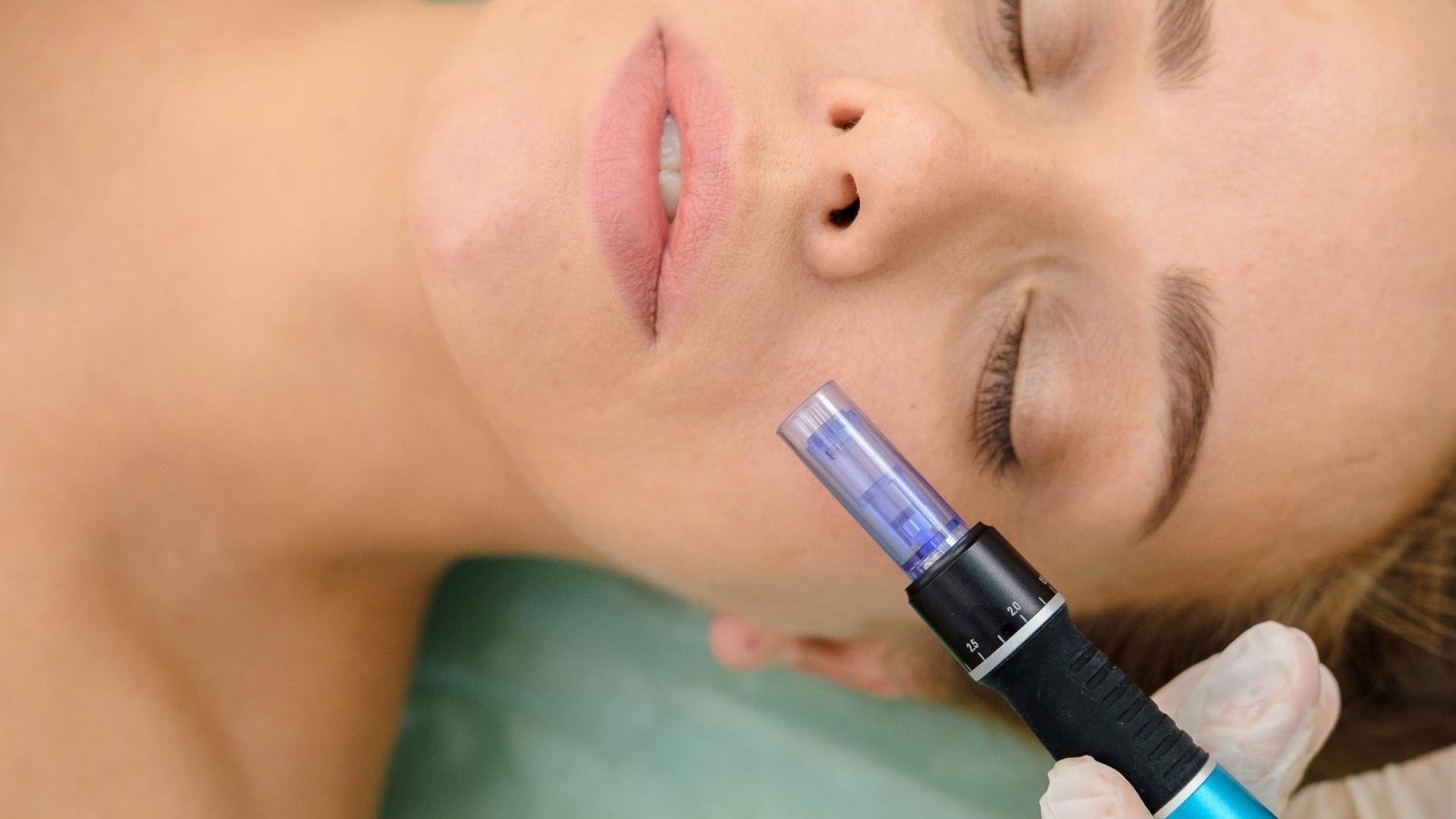 This At-Home Micro-Needling Kit Is So Good, My Husband Can’t Stop Raving About My Complexion